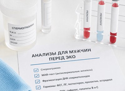 Какие анализы сдавать мужчине перед ЭКО